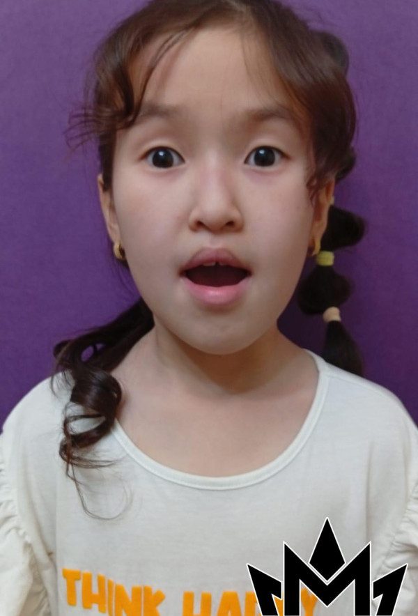 Еркем Ермек